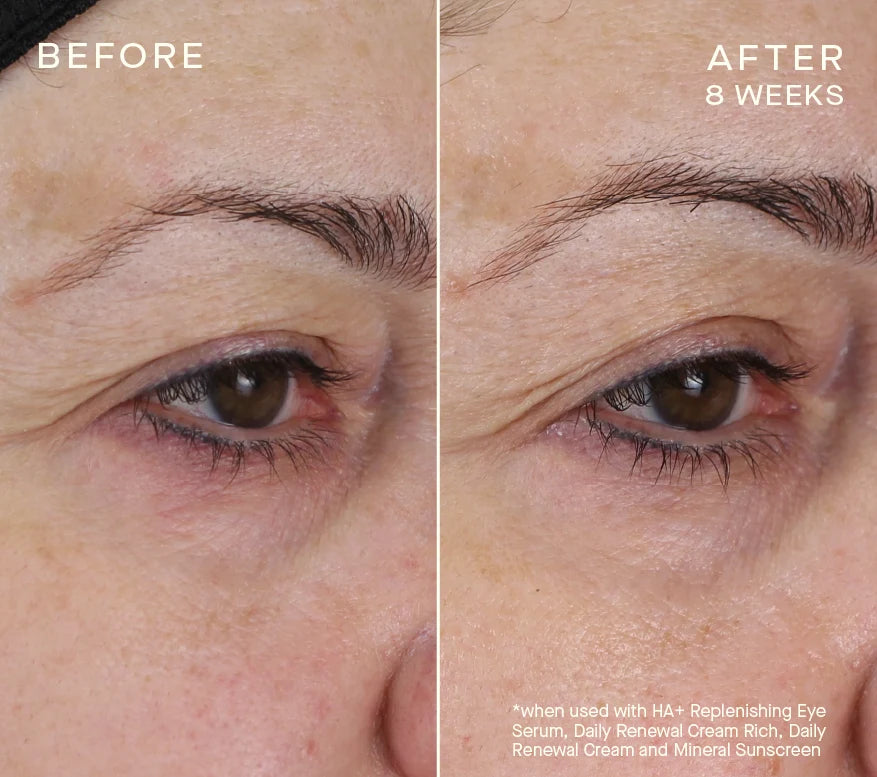Advanced Regenerative Eye Serum