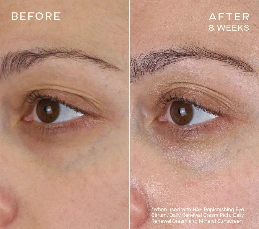 Advanced Regenerative Eye Serum