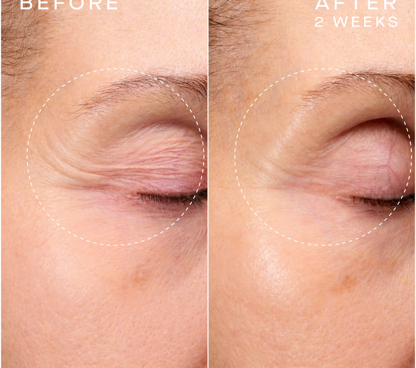 Advanced Regenerative Serum - 15ML
