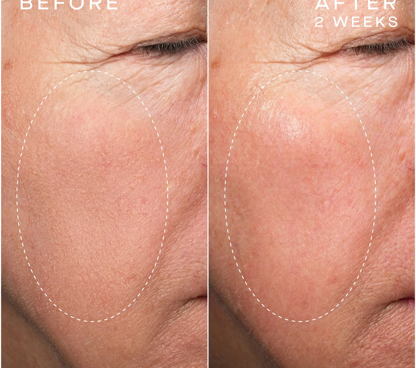 Advanced Regenerative Serum - 15ML
