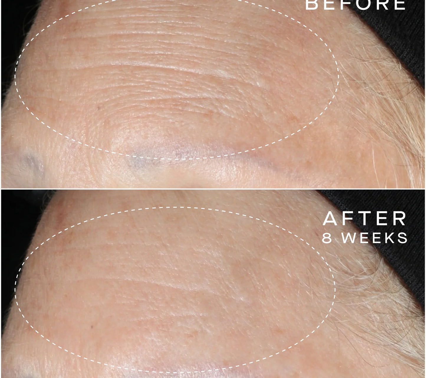 Advanced Regenerative Serum - 15ML