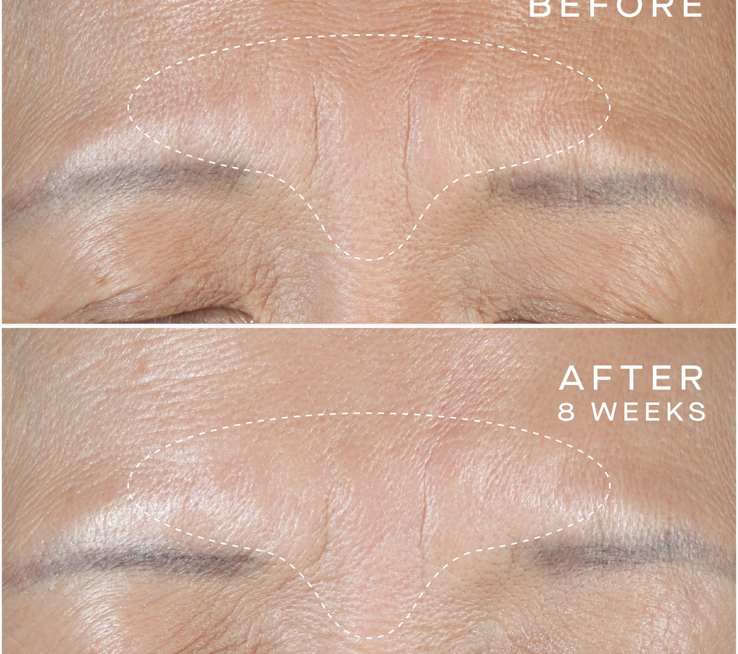 Advanced Regenerative Serum - 15ML