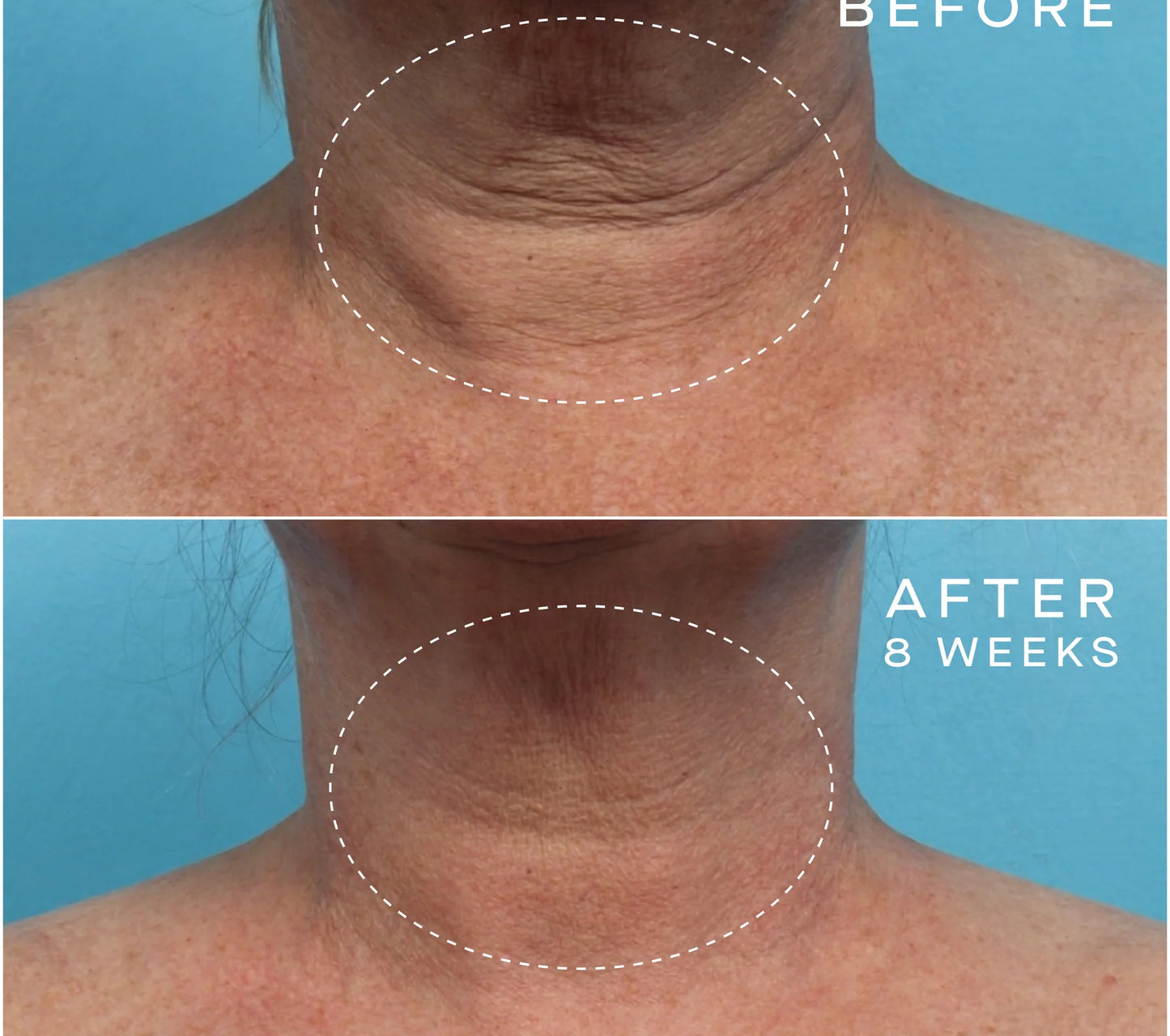 Advanced Regenerative Serum - 15ML