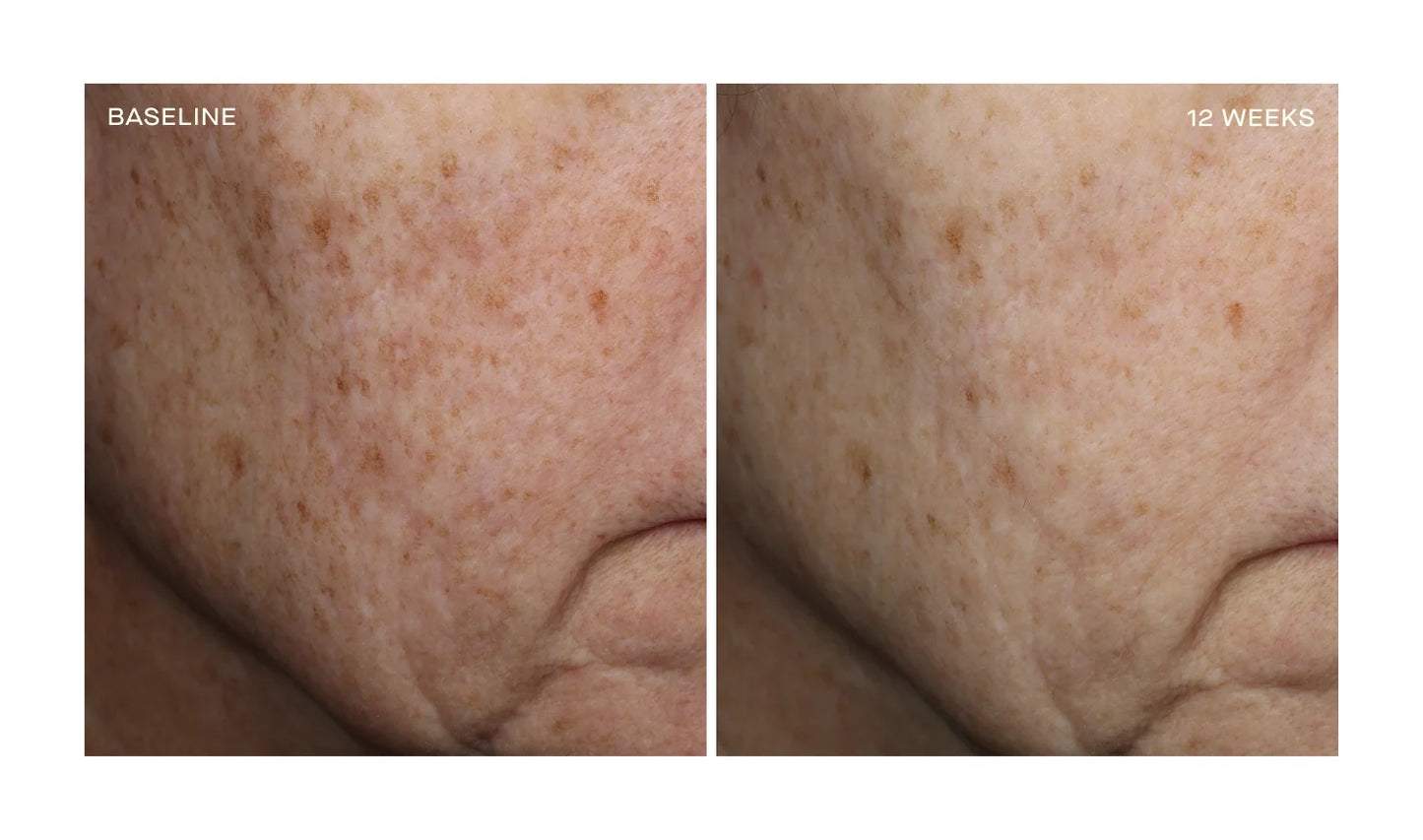 Complexion Brightening Serum