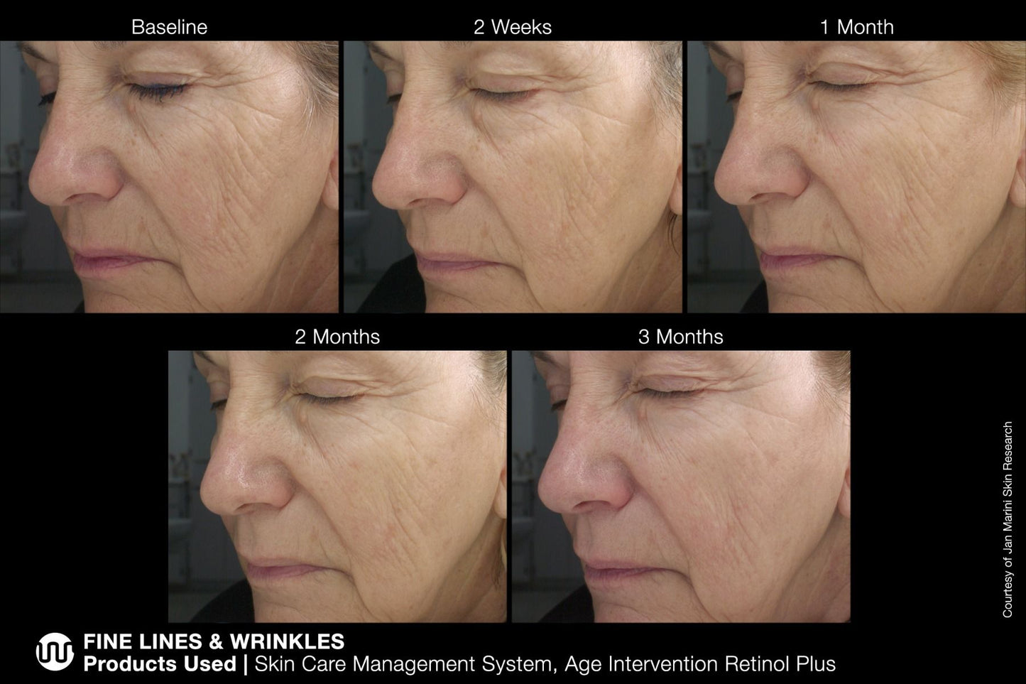 Age Intervention Retinol Plus